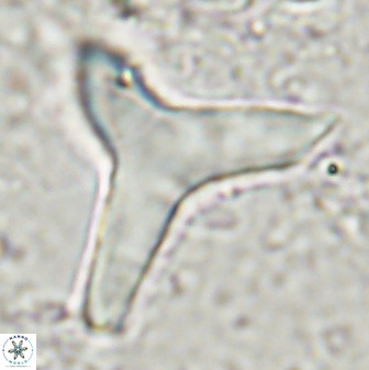 Tribrachiatus orthastylus 48964