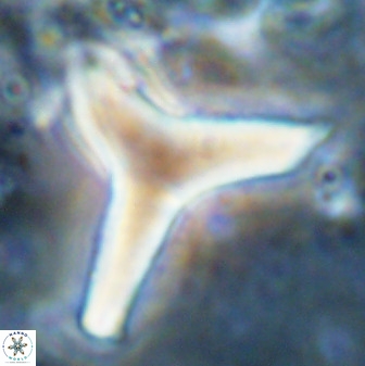 Tribrachiatus orthastylus 48965
