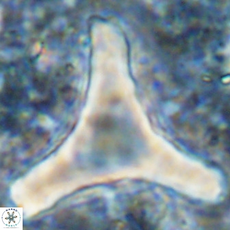 Tribrachiatus orthastylus 48994