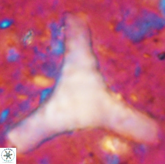 Tribrachiatus orthastylus 48991