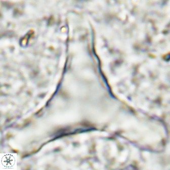 Tribrachiatus orthastylus 48993