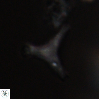 Tribrachiatus orthostylus 24301