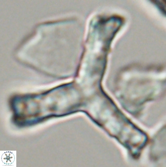 Tribrachiatus orthostylus 24336