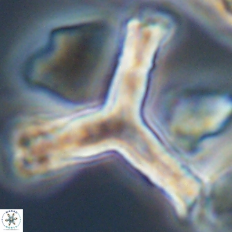 Tribrachiatus orthostylus 24337