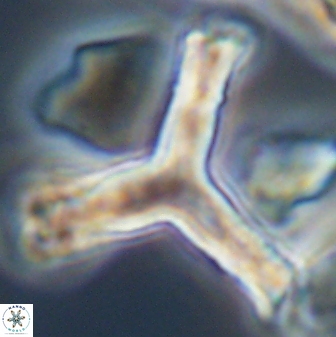 Tribrachiatus orthostylus 24338