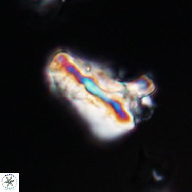 Tripinnalithus shetlandensis 11459