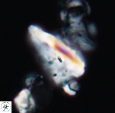 Tripinnalithus shetlandensis 11660