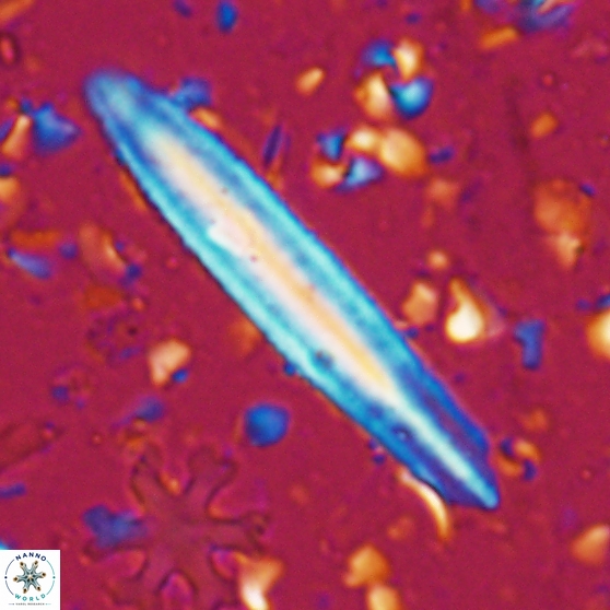 Triquetrorhabdulus carinatus dentatus 28075
