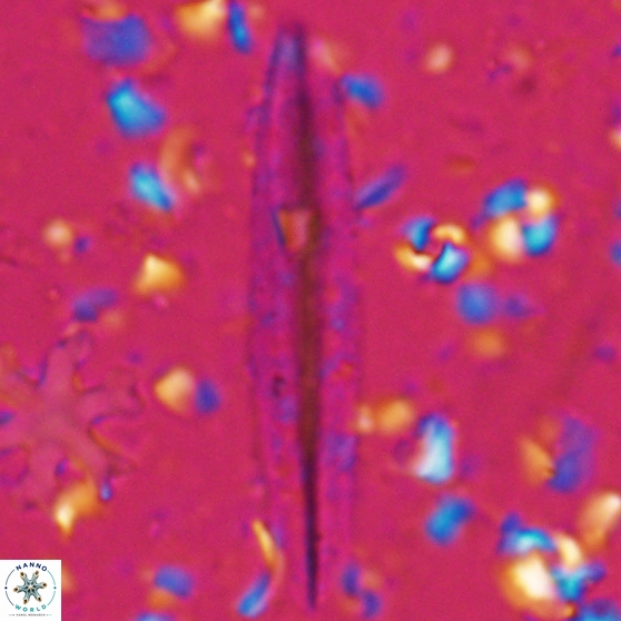 Triquetrorhabdulus carinatus dentatus 28076