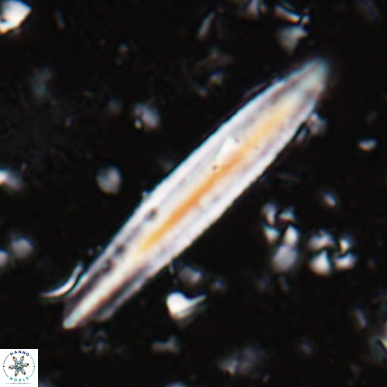 Triquetrorhabdulus carinatus dentatus 28079