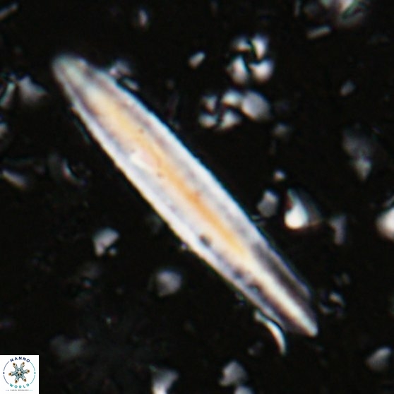 Triquetrorhabdulus carinatus dentatus 28073