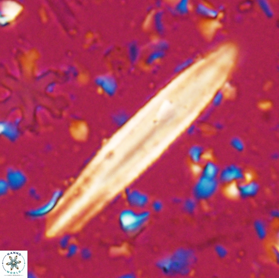 Triquetrorhabdulus carinatus dentatus 28080
