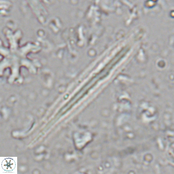 Triquetrorhabdulus carinatus dentatus 28081