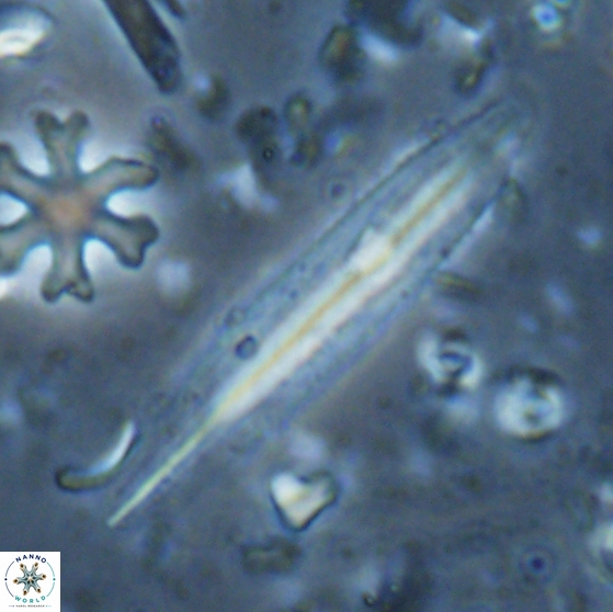 Triquetrorhabdulus carinatus dentatus 28083