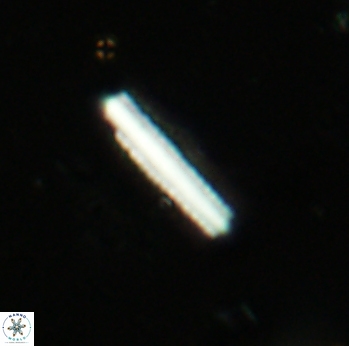 Triquetrorhabdulus carinatus dentatus 2312
