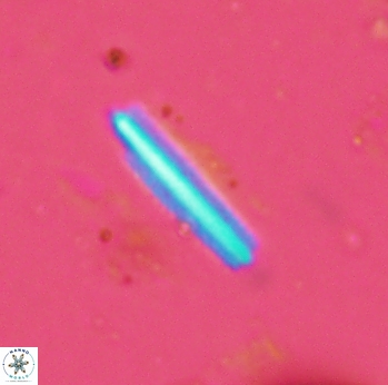 Triquetrorhabdulus carinatus dentatus 2314