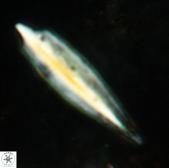 Triquetrorhabdulus carinatus eurys 2319