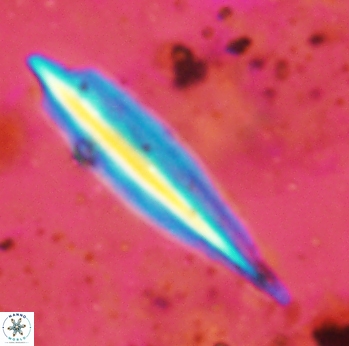 Triquetrorhabdulus carinatus eurys 2320