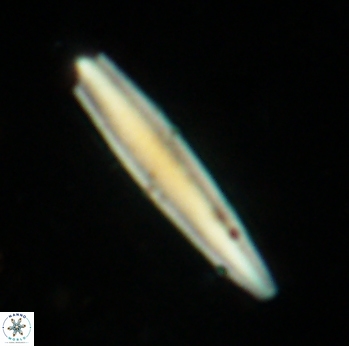 Triquetrorhabdulus carinatus rimosus 2315