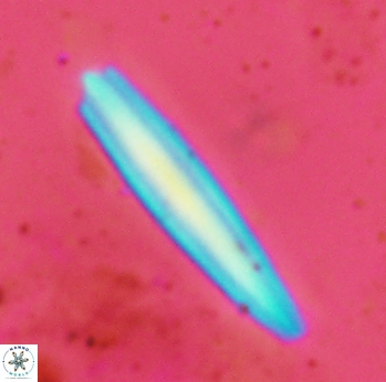 Triquetrorhabdulus carinatus rimosus 2318