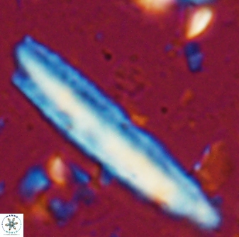 Triquetrorhabdulus carinatus rimosus 27815