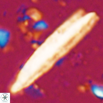 Triquetrorhabdulus carinatus rimosus 27822
