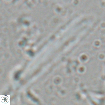 Triquetrorhabdulus carinatus rimosus 27823
