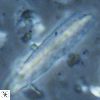 Triquetrorhabdulus carinatus rimosus 27824