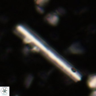 Triquetrorhabdulus carinatus 240