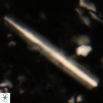 Triquetrorhabdulus carinatus 241