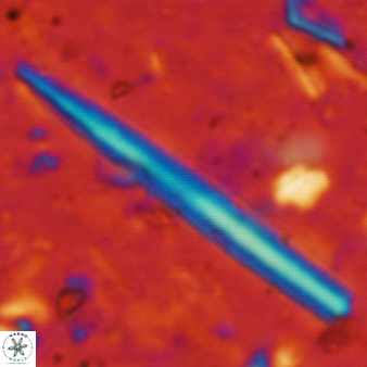 Triquetrorhabdulus carinatus 242
