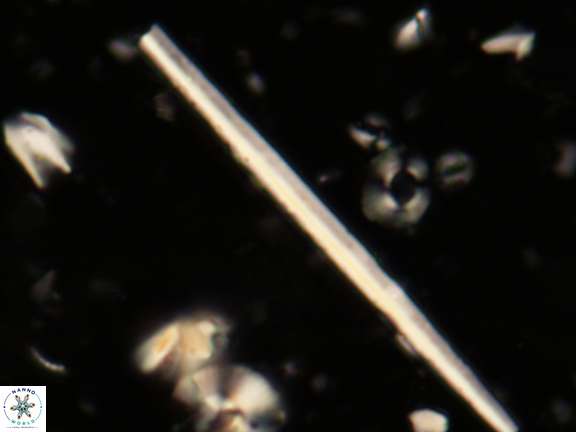 Triquetrorhabdulus carinatus 263