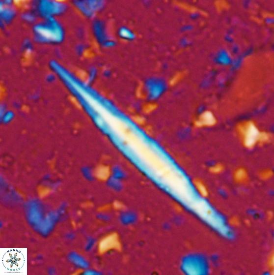 Triquetrorhabdulus carinatus 27865