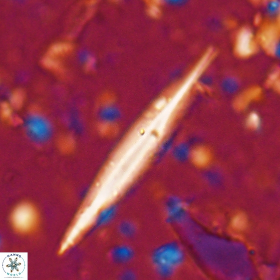 Triquetrorhabdulus carinatus 27866