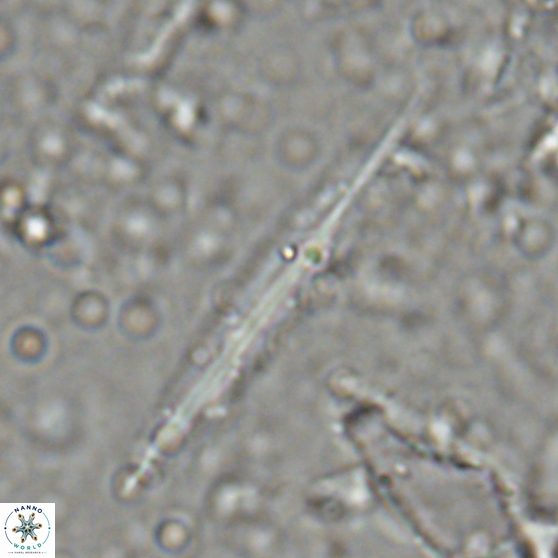 Triquetrorhabdulus carinatus 27868