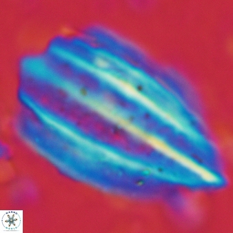 Triquetrorhabdulus challengeri 119