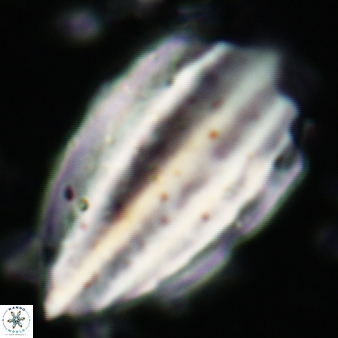 Triquetrorhabdulus challengeri 120