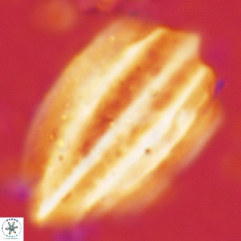 Triquetrorhabdulus challengeri 121