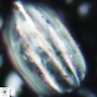 Triquetrorhabdulus challengeri 1897