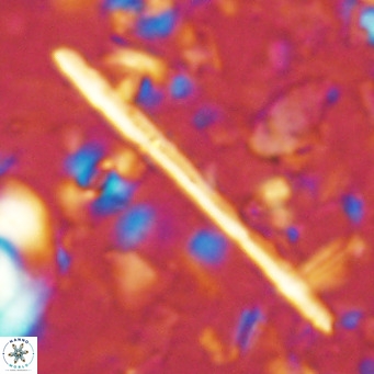 Triquetrorhabdulus longus VR 16554