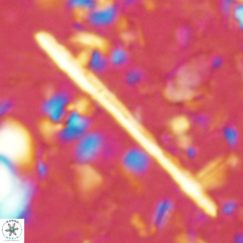 Triquetrorhabdulus longus VR 16555