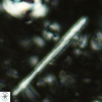 Triquetrorhabdulus longus VR 16557