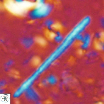 Triquetrorhabdulus longus VR 16558