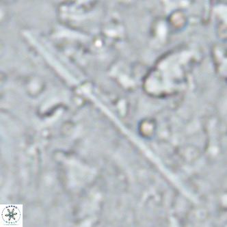 Triquetrorhabdulus longus VR 16565