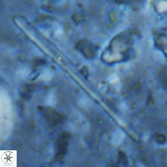 Triquetrorhabdulus longus VR 16566