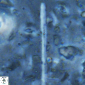 Triquetrorhabdulus longus VR 16567