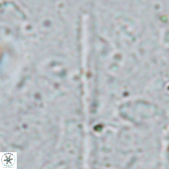 Triquetrorhabdulus longus VR 16563