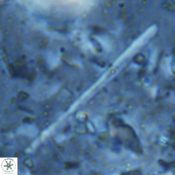 Triquetrorhabdulus longus VR 16570