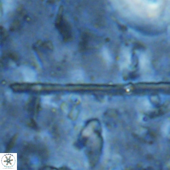 Triquetrorhabdulus longus VR 16571
