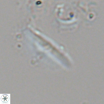 Triquetrorhabdulus milowii 22703